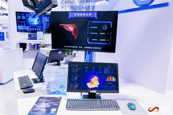 商汤“SenseCare®智慧医院”亮相CHIMA  大模型赋能医院智慧化转型(图2)