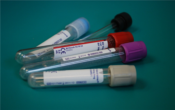 这6种病听起来能吓坏人 但基本不用治：别再花冤枉钱了！(图1)