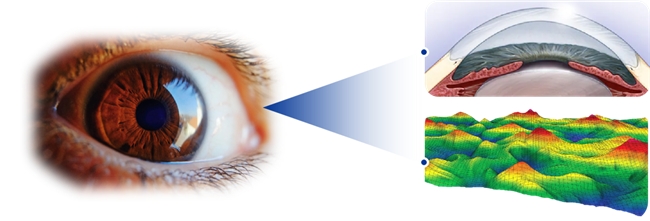 郑州普瑞丨量眼定制独一无二的清晰,个性化近视手术,为您提供极致的视觉体验!(图1) 郑州普瑞丨量眼定制独一无二的清晰,个性化近视手术,为您提供极致的视觉体验!(图1)