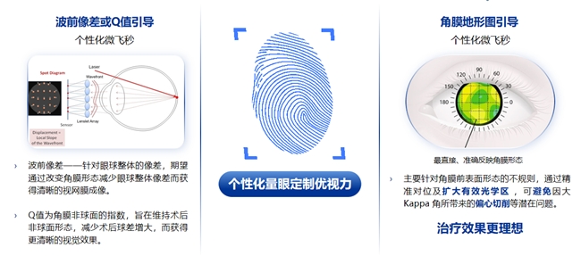 郑州普瑞丨量眼定制独一无二的清晰,个性化近视手术,为您提供极致的视觉体验!(图2) 郑州普瑞丨量眼定制独一无二的清晰,个性化近视手术,为您提供极致的视觉体验!(图2)
